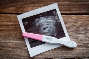 pregnancy test and ultrasound image